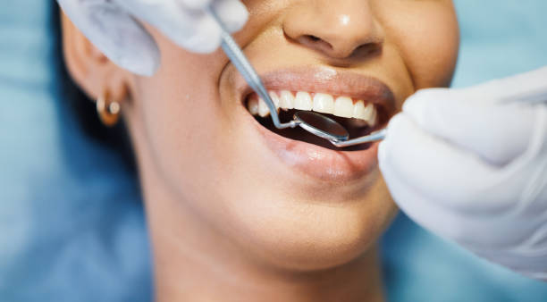 Best Tooth Infection Emergency Dentist  in Thedral City, CA